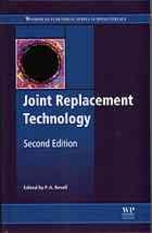Joint replacement technology