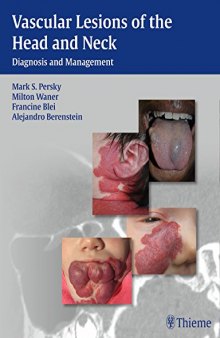 Vascular Lesions of the Head and Neck: Diagnosis and Management