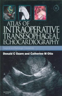 Atlas of Intraoperative Transesophageal Echocardiography