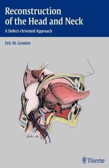 Reconstruction of the head and neck : a defect-oriented approach