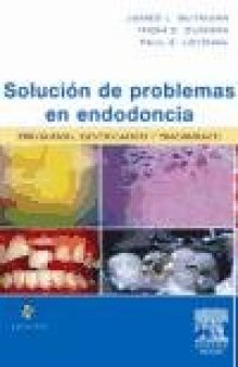 Solucion de Problemas En Endodoncia