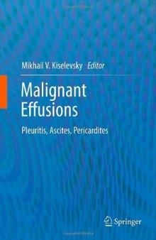 Malignant Effusions: Pleuritis, Ascites, Pericardites