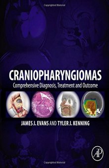Craniopharyngiomas: Comprehensive Diagnosis, Treatment and Outcome