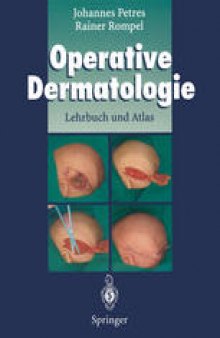 Operative Dermatologie: Lehrbuch und Atlas