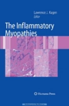 The Inflammatory Myopathies