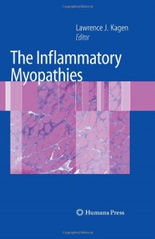 The Inflammatory Myopathies