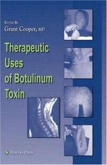 Therapeutic Uses of Botulinum Toxin (Musculoskeletal Medicine)