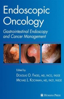 Endoscopic Extraperitoneal Radical Prostatectomy