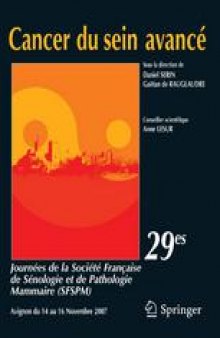 Cancer du sein avancé: 29es Journées de la Société Française de Sénologie et Pathologie Mammaire (SFSPM) Avignon, 14–16 novembre 2007