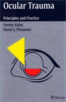 Ocular trauma : principles and practice