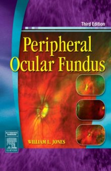 Peripheral Ocular Fundus, Third Edition  