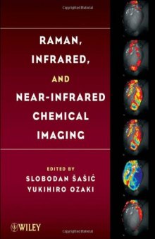 Raman, Infrared, and Near-Infrared Chemical Imaging  