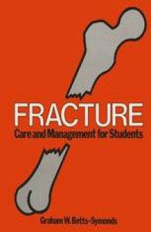 Fracture: Care and Management for Students