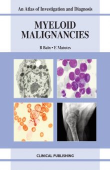 Myeloid Malignancies: An Atlas of Investigation and Diagnosis