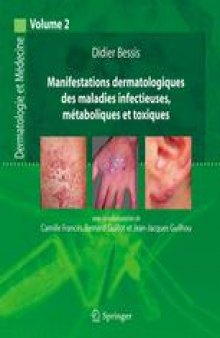 Manifestations dermatologiques des maladies infectieuses, métaboliques et toxiques: Dermatologie et médecine, vol. 2