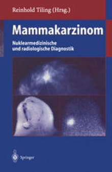 Mammakarzinom: Nuklearmedizinische und radiologische Diagnostik