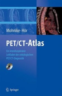 PET CT Atlas - ein interdiziplinärer Leitfaden der onkologischen PET CT Diagnostik