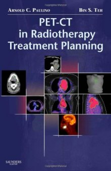 PET-CT in Radiotherapy Treatment Planning, 1e