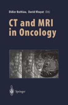 CT and MRI in Oncology