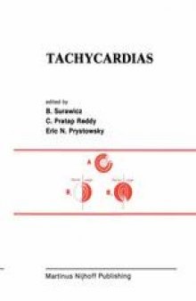 Tachycardias