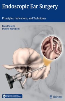 Endoscopic ear surgery : principles, indications, and techniques