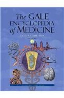 Gale Encyclopedia of Medicine