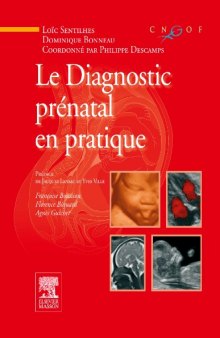 Le diagnostic prénatal en pratique