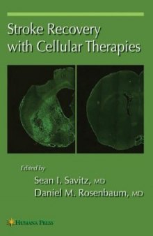 Stroke Recovery with Cellular Therapies (Current Clinical Neurology)