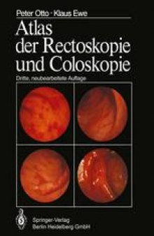 Atlas der Rectoskopie und Coloskopie