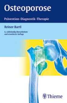 Osteoporose : Prävention, Diagnostik, Therapie