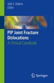 PIP Joint Fracture Dislocations: A Clinical Casebook