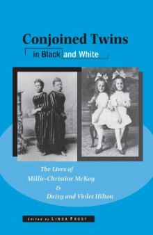 Conjoined Twins in Black and White: The Lives of Millie-Christine McKoy and Daisy and Violet Hilton (Wisconsin Studies in Autobiography)